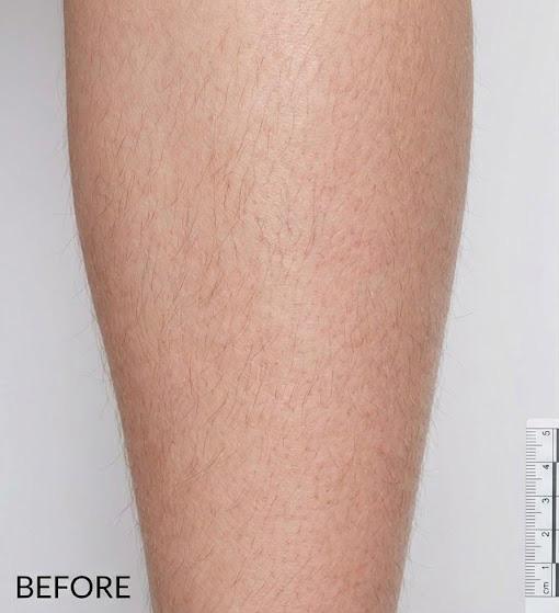 Legs Before